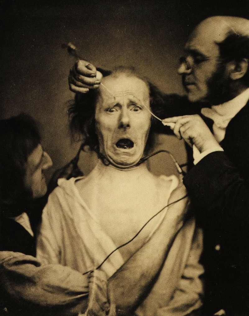 Illustration for article titled Terrifying, Century-Old Photographs from Neuroscience Experiments